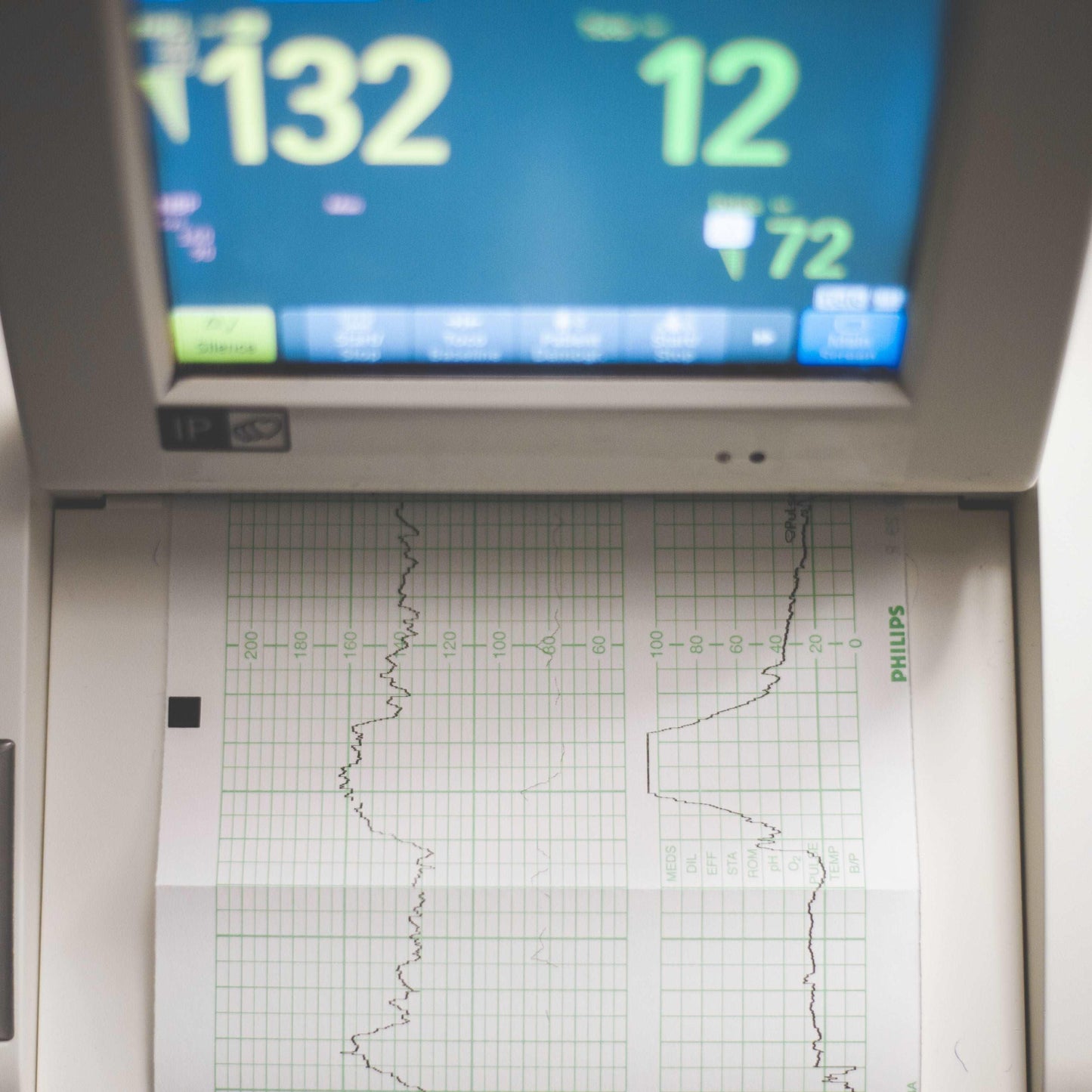 Electrocardiogram (ECG) - Thunder Bay - First Aid Plus 